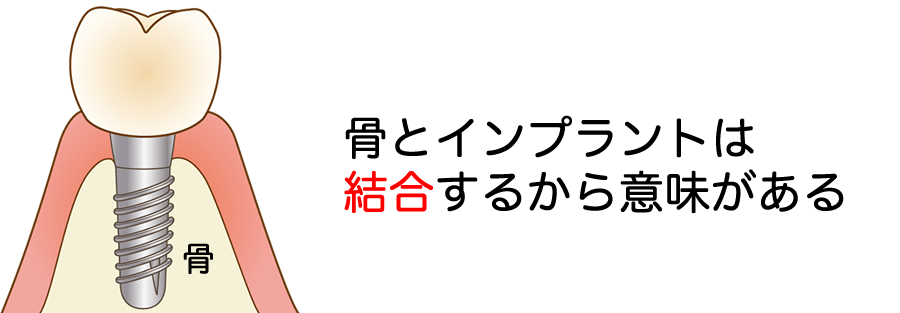 インプラントの説明用イラスト1