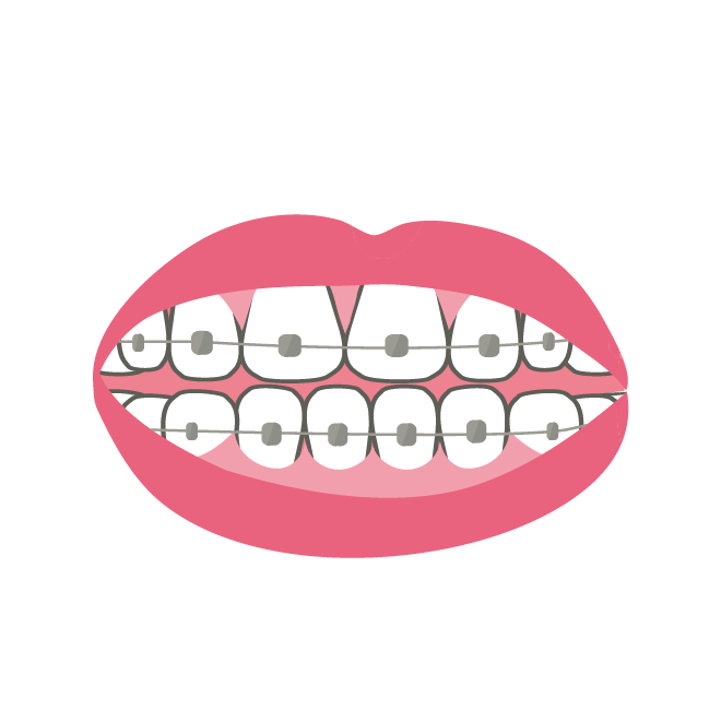 矯正後の注意点 坂井歯科医院ブログ