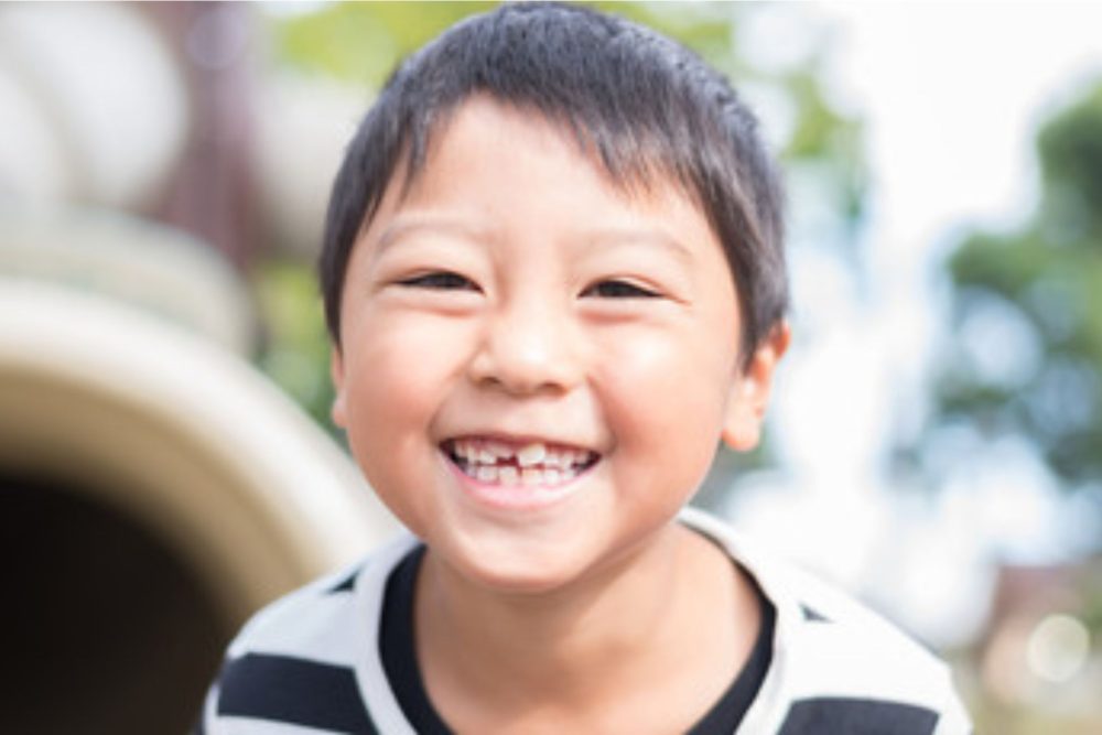 永久歯が生えてこない4つの原因
