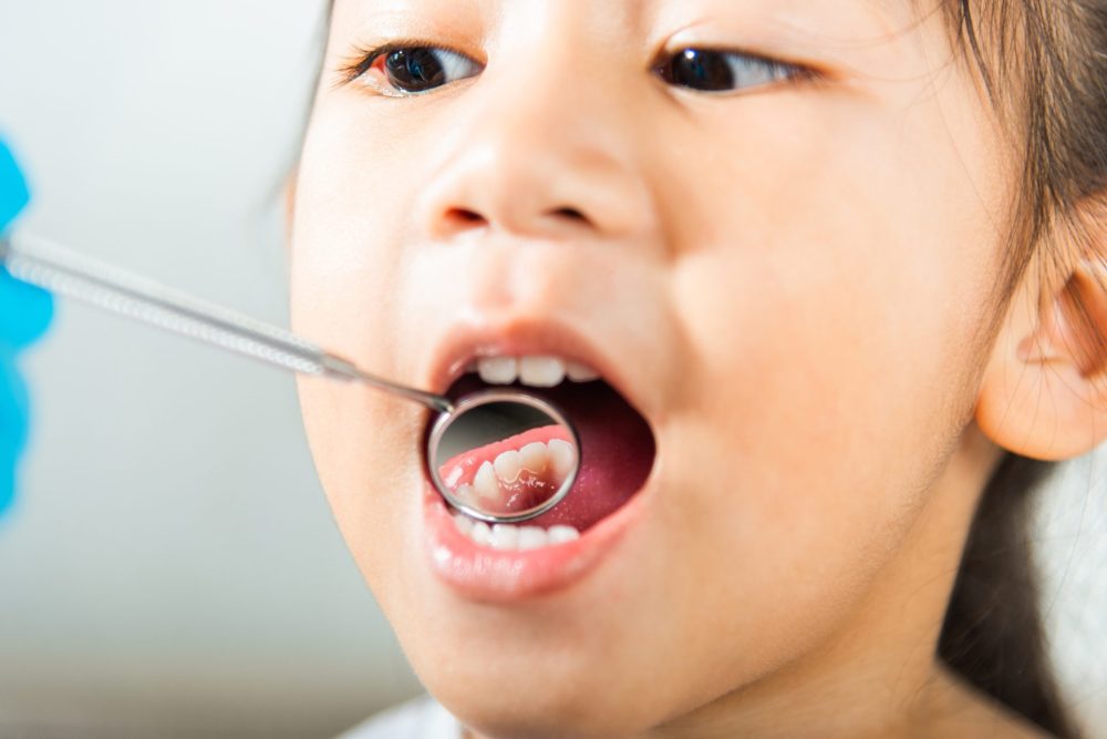 6.第一小臼歯（前から4番目）：9～11歳ころ