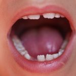 乳歯　生え変わり