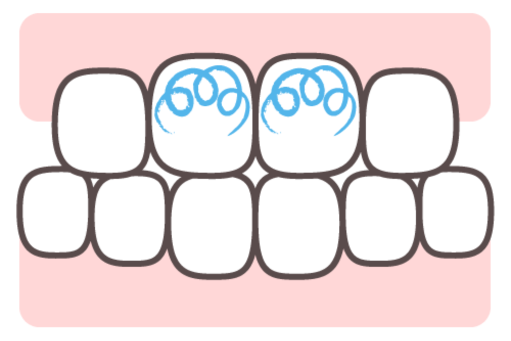 子どもが磨き終わったら「らせん磨き」で仕上げする
