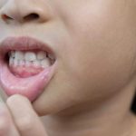 虫歯になりにくいおやつ