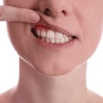 歯茎から血が出る5つの原因｜受診する6つの目安や対処法も徹底解説