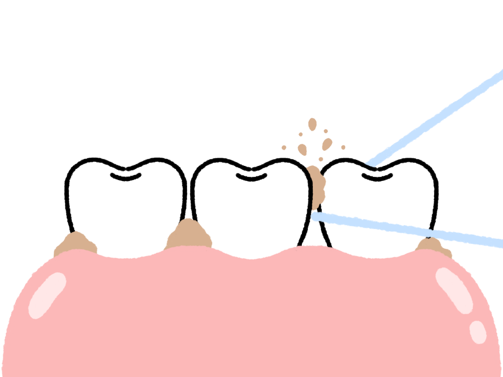 歯の側面に沿わせるようにゆっくり動かすのがポイント