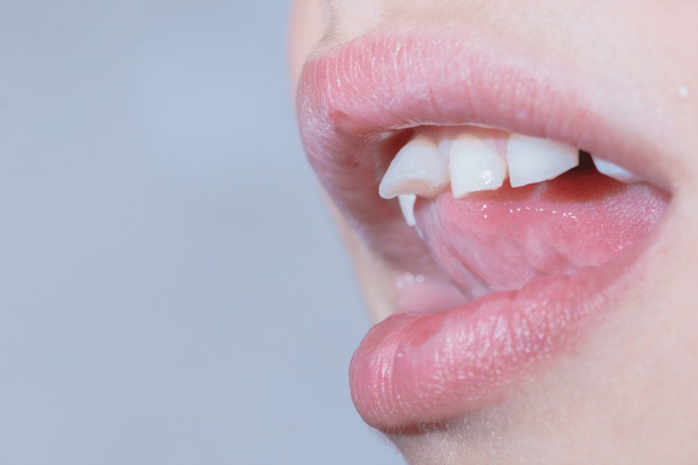 表面の状態で見分ける