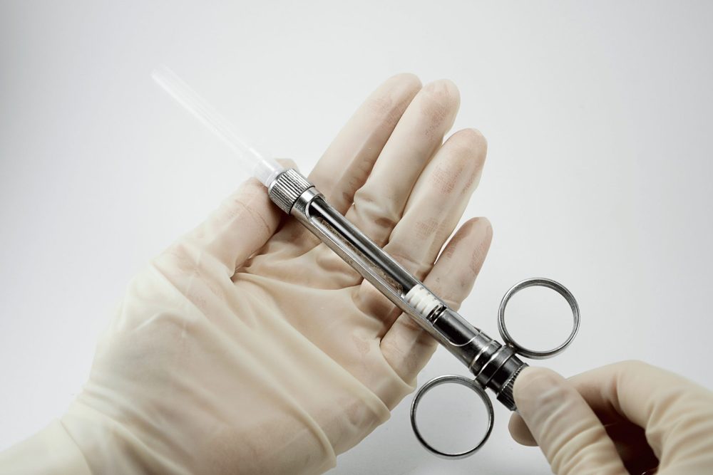 麻酔が効きにくい下の親知らずには伝達麻酔で対応