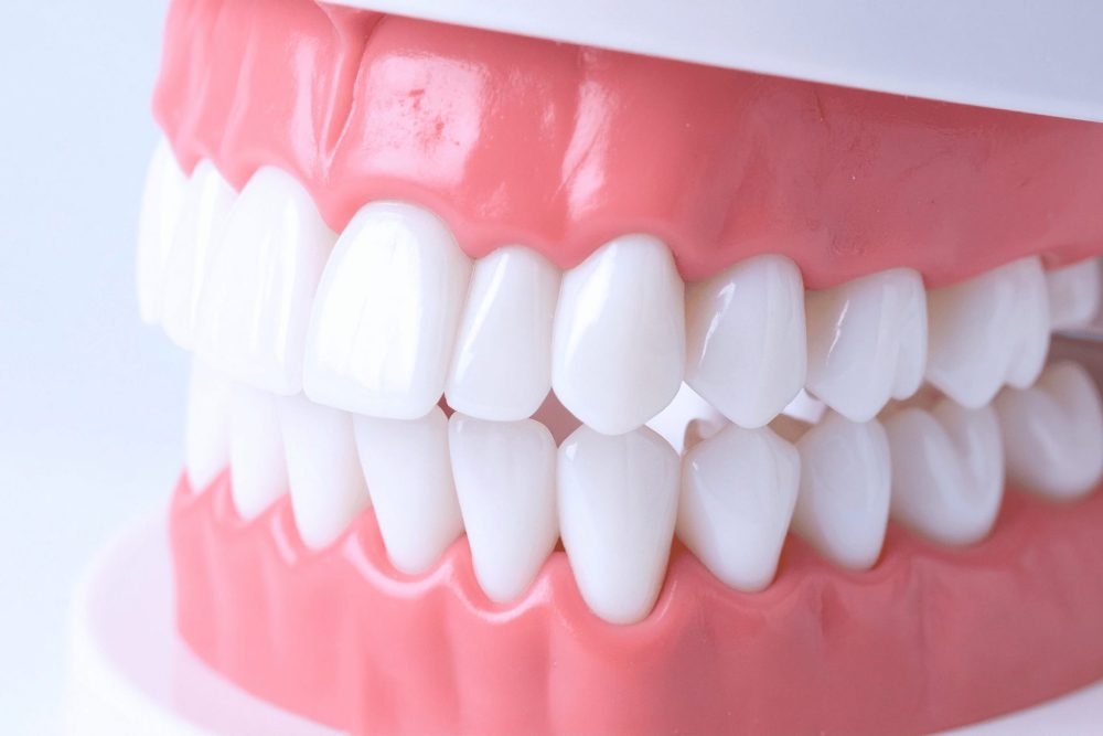 まっすぐ生えて噛みあっている