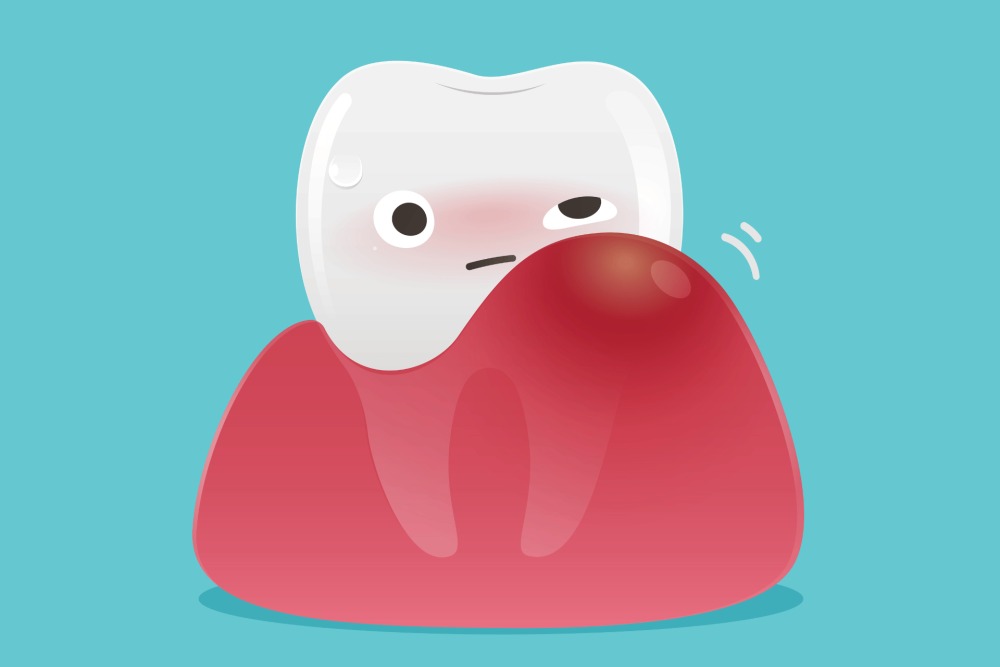 痛みを軽減するには炎症を抑えておくことが大切