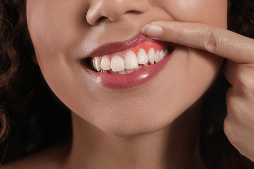 歯ぐきの見た目や位置の変化