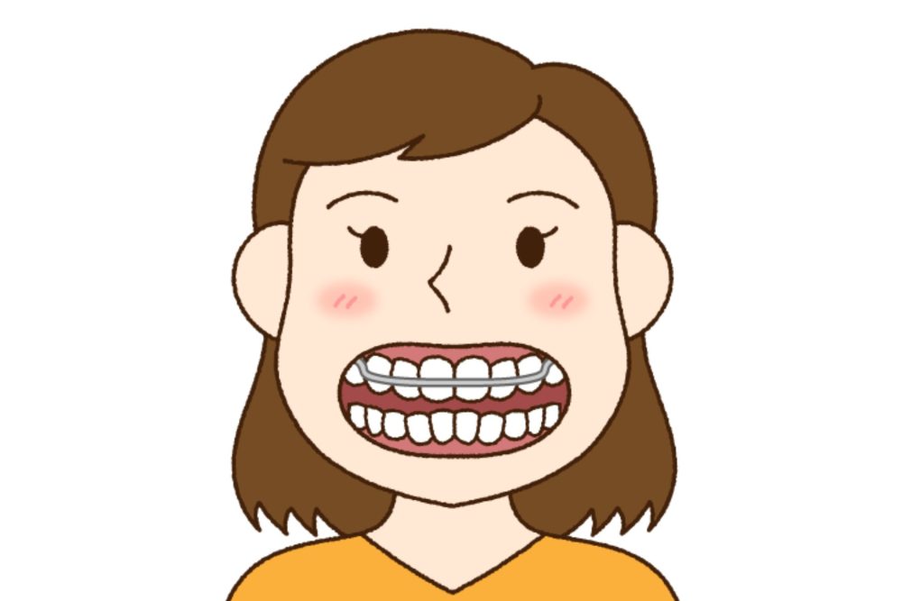 歯列矯正を検討している場合