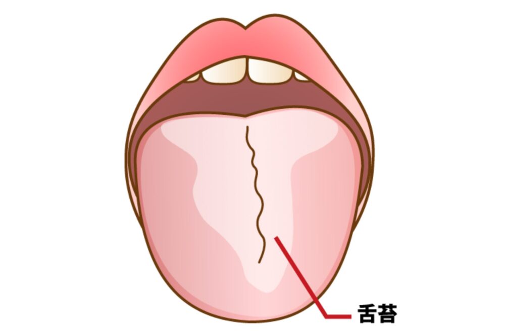 舌苔